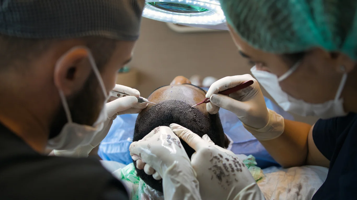 Hair Transplant