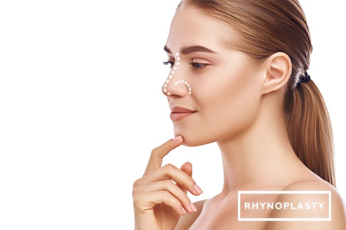 Side profile showing the nose — Rhinoplasty