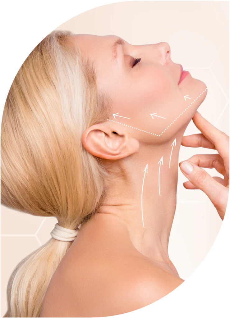 Neck and jawline — Neck Lift