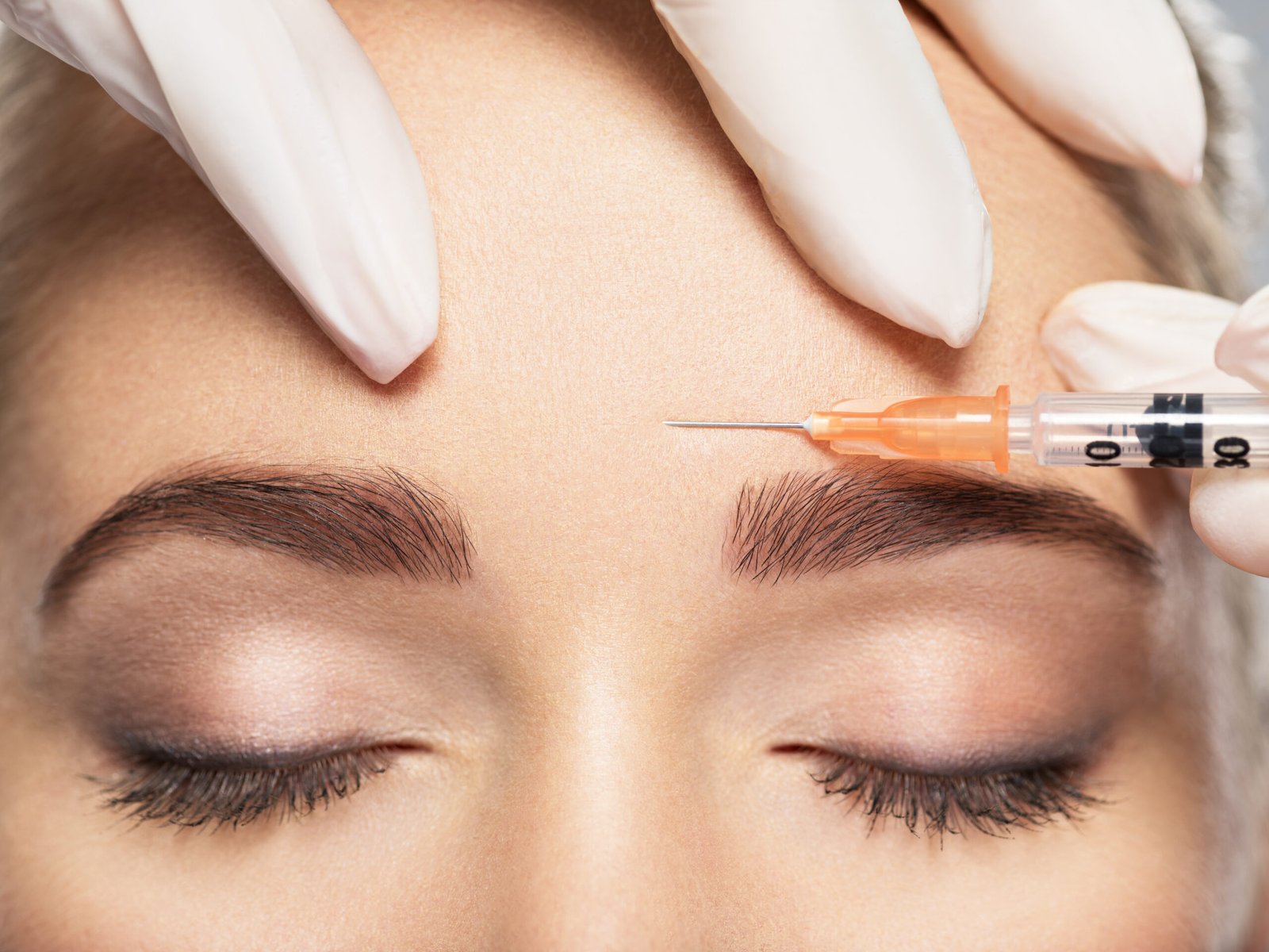 Close up of forehead and facial lines — Botox